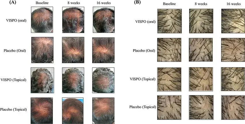 Wie viele Haare hat ein Mensch? Zahlen, Fakten & Einflussfaktoren