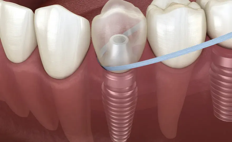 Si possono lavare i denti prima di un intervento?