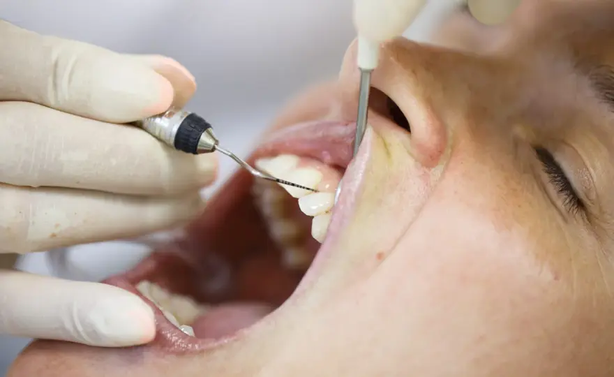 ¿Qué hace un periodoncista y cuándo conviene pedir cita?