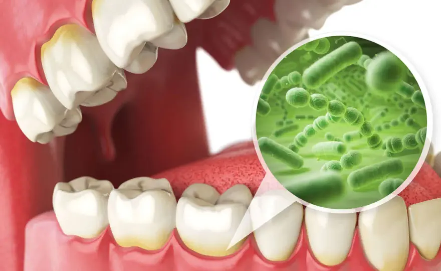 Microbiota orale - La guida per una bocca sana ogni giorno
