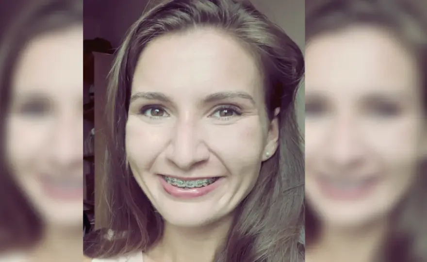 Kiedy trzeba nosić aparat na zęby? Zobacz, co musisz wiedzieć