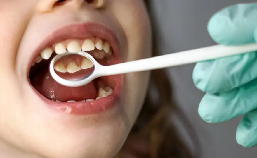 Ciuccio e denti da latte - come proteggerli dalla carie