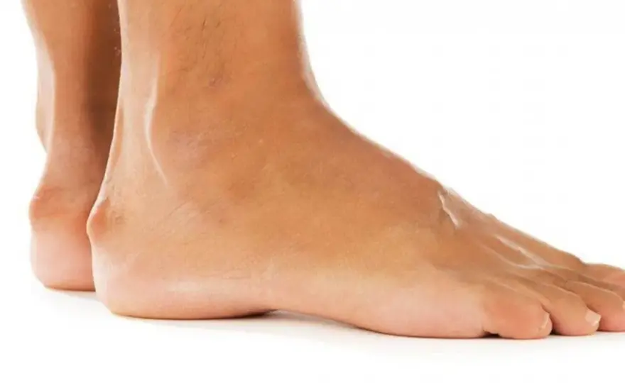 Osso che sporge piede bambino - Quando preoccuparsi?