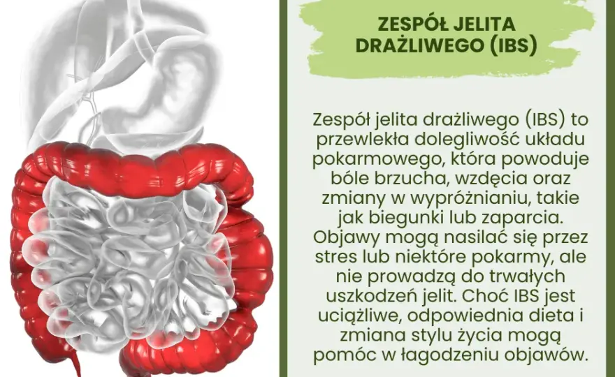 Jelito drażliwe - charakterystyczne objawy zespołu