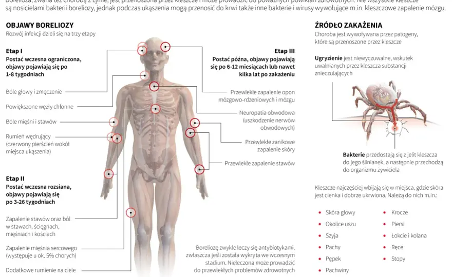 Borelioza objawy po latach - jak nieleczona choroba wpływa na zdrowie?