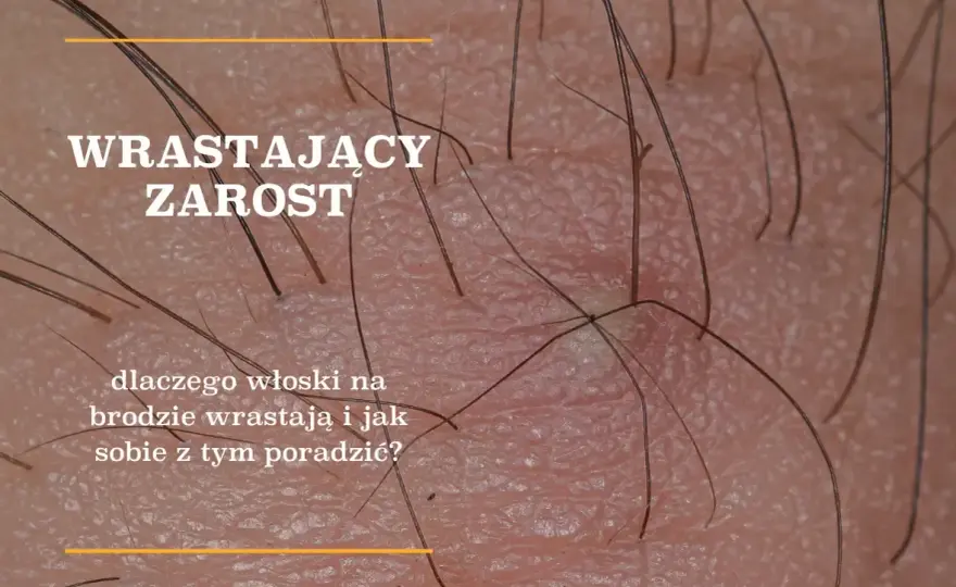 Kiedy rośnie zarost? Wiek, etapy i indywidualny rozwój