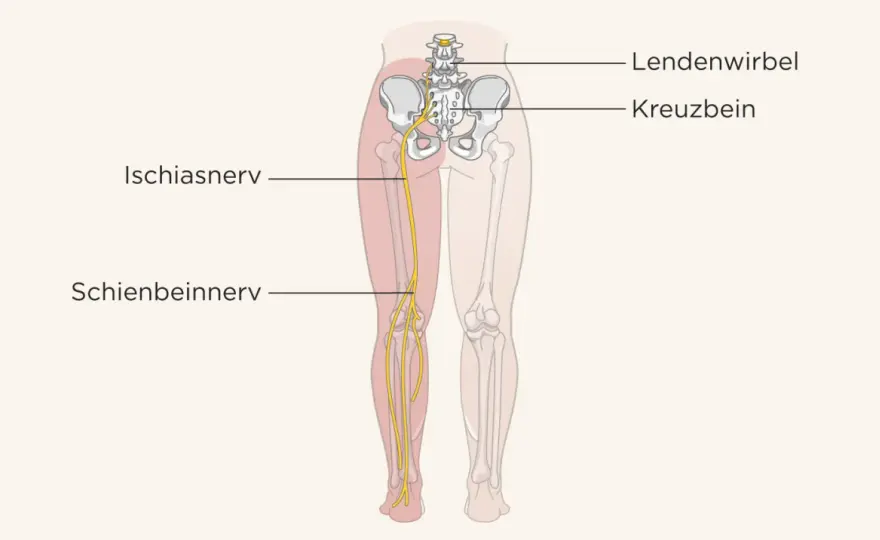 Wo sitzt der Ischiasnerv? Verlauf, Beschwerden und was hilft