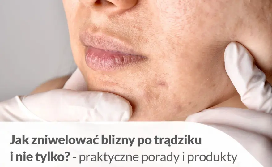 Jak usunąć blizny domowym sposobem? Co naprawdę działa