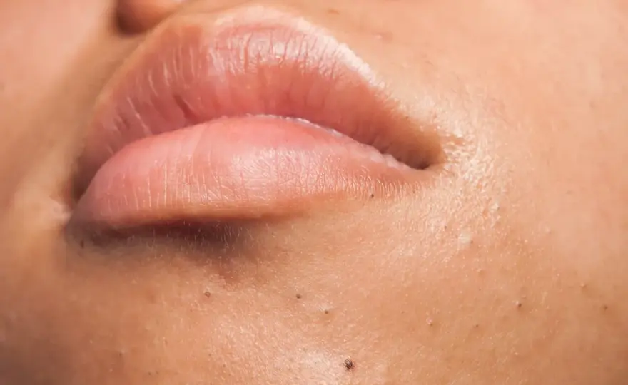 Comment enlever les comédons sans abîmer sa peau ?