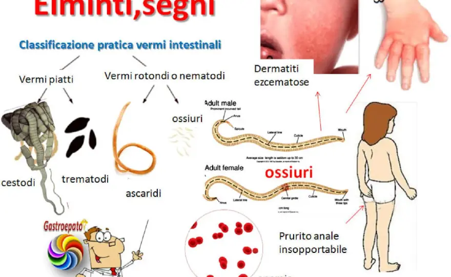 Vermi intestinali, quali sintomi sono davvero indicativi?