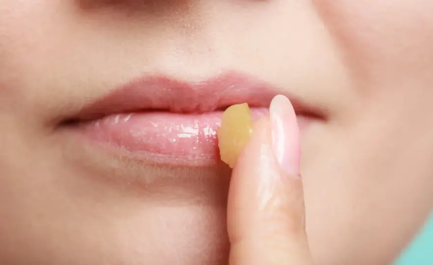 Labbra infiammate, i rimedi della nonna più sicuri