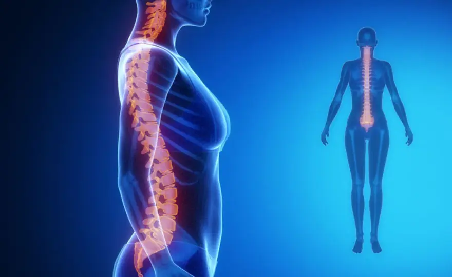 Lordoza lędźwiowa - Kiedy boli i jak wrócić do sprawności?