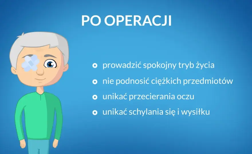 Zalecenia po operacji zaćmy: uniknij najczęstszych błędów w pielęgnacji