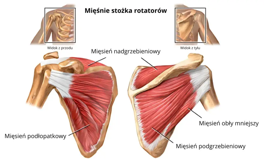Ból barku - przeciążenie czy uszkodzenie stożka rotatorów?
