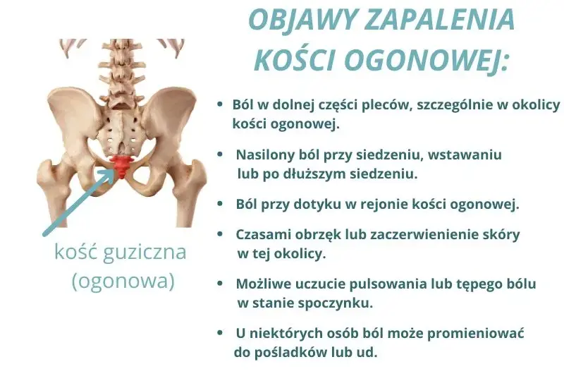 Ból kości ogonowej: Przyczyny, objawy i skuteczne leczenie