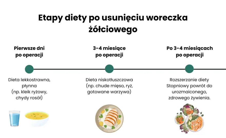 Usunięcie woreczka żółciowego - Operacja, dieta, powrót do zdrowia