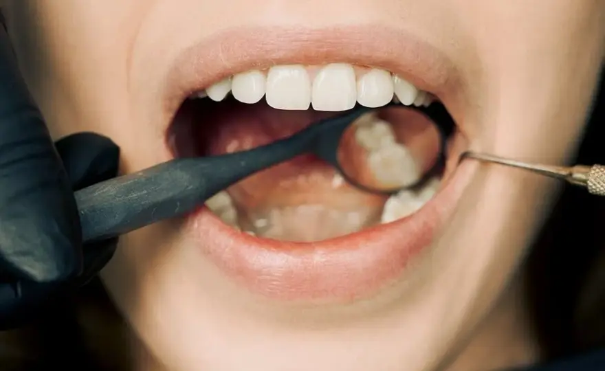 Antybiotyk na ząb z ropą: Co działa i kiedy do dentysty?