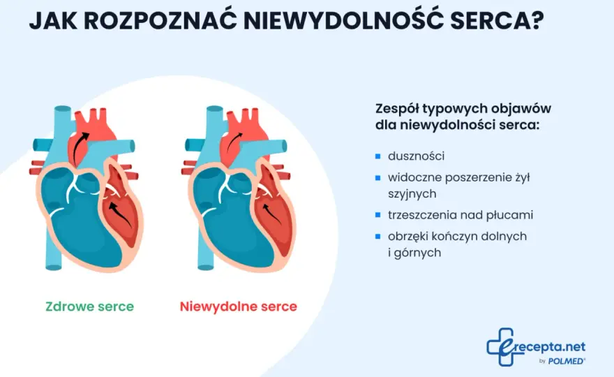 Niewydolność serca - objawy, których nie wolno ignorować