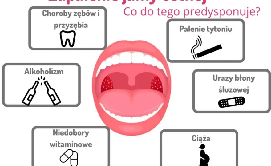 Zapalenie jamy ustnej: Szybkie sposoby, leki i kiedy iść do lekarza