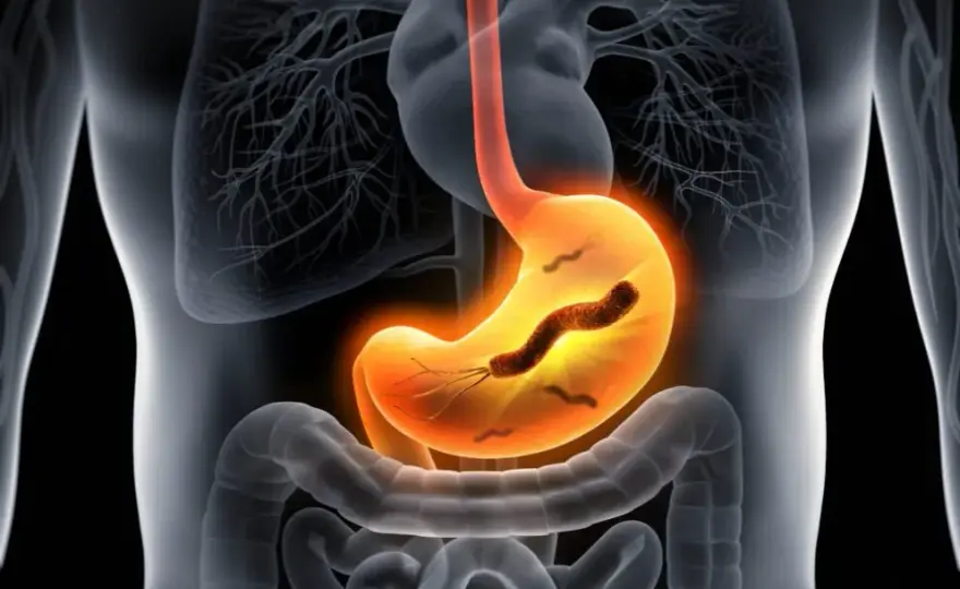 Helicobacter pylori w kale: Co oznacza pozytywny wynik testu?