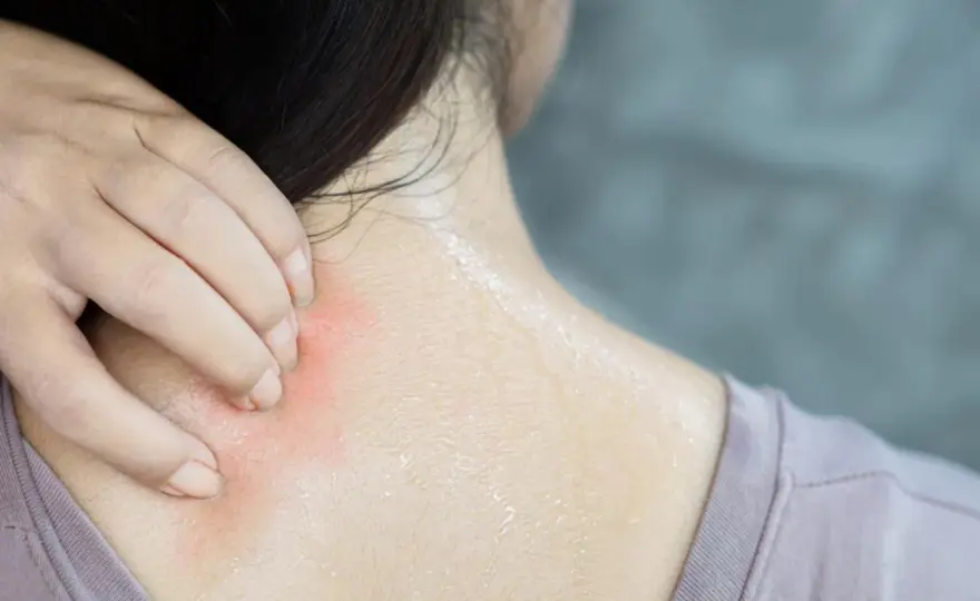 Prurito alla nuca e sul collo - cause e rimedi sicuri