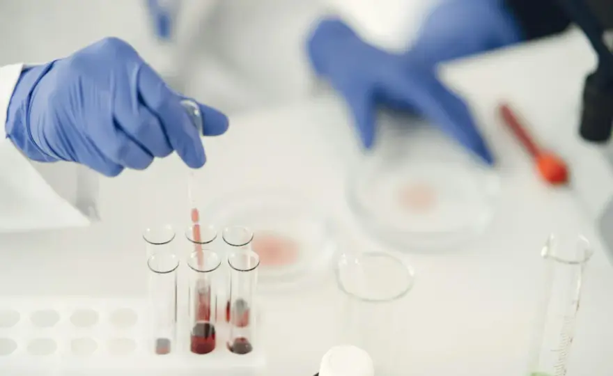 Mycoplasma genitalium - objawy, test PCR i co robić po wyniku