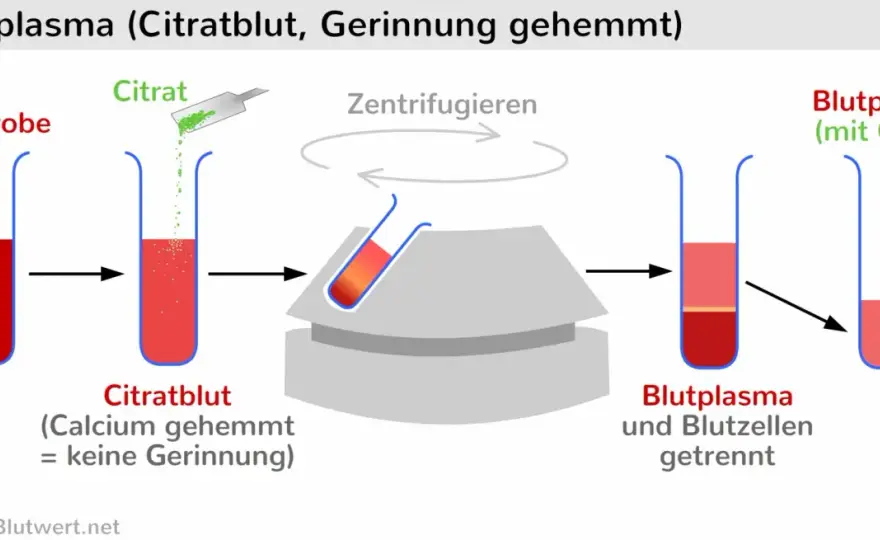 Quick-Wert erklärt - was der Laborwert über die Gerinnung sagt