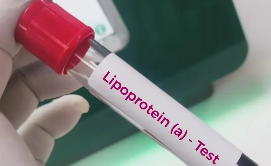 Badanie lipoproteiny(a) - Dlaczego zwykły lipidogram to za mało?