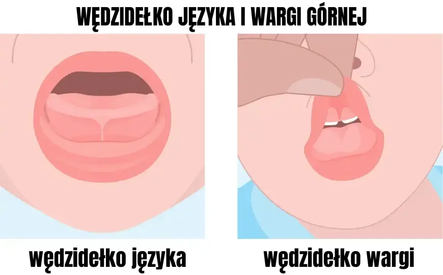 Podcięcie wędzidełka: Kiedy ćwiczyć, a kiedy sport? Poradnik