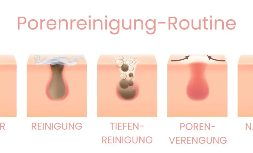 Geschlossene Komedonen - Endlich freie Poren!