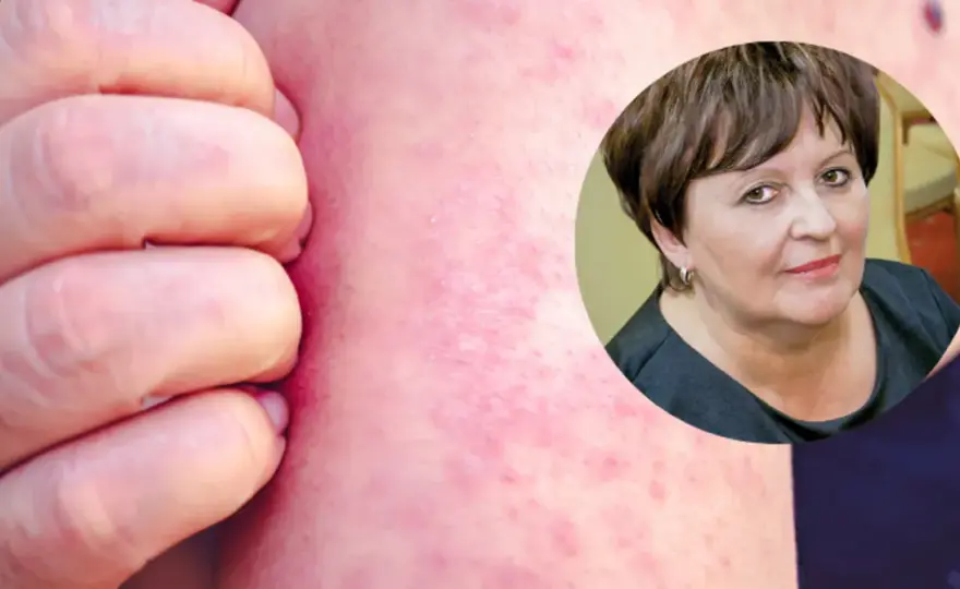 "Disease" po polsku: Poznaj znaczenie i synonimy
