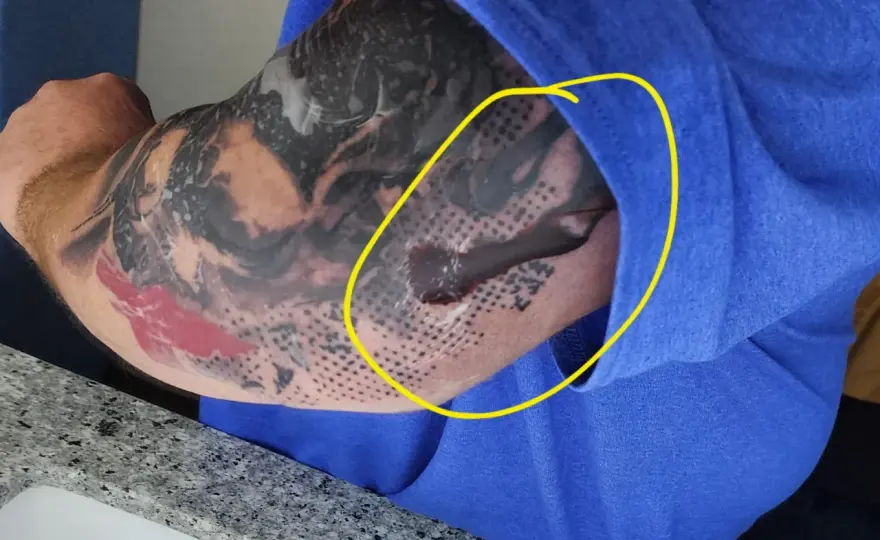 Odparzenie po second skin - Co robić? Poradnik dla tatuażu