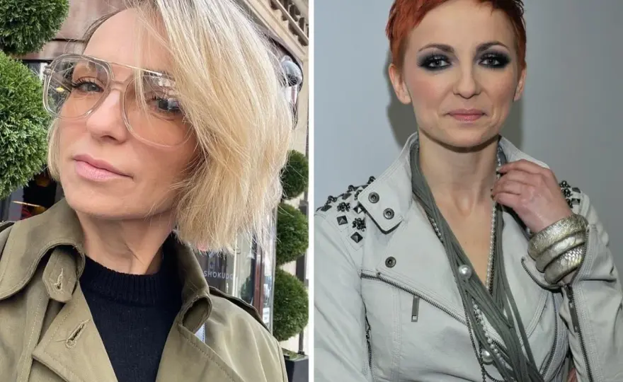 Anna Wyszkoni - operacje plastyczne czy metamorfoza? Prawda o zmianach