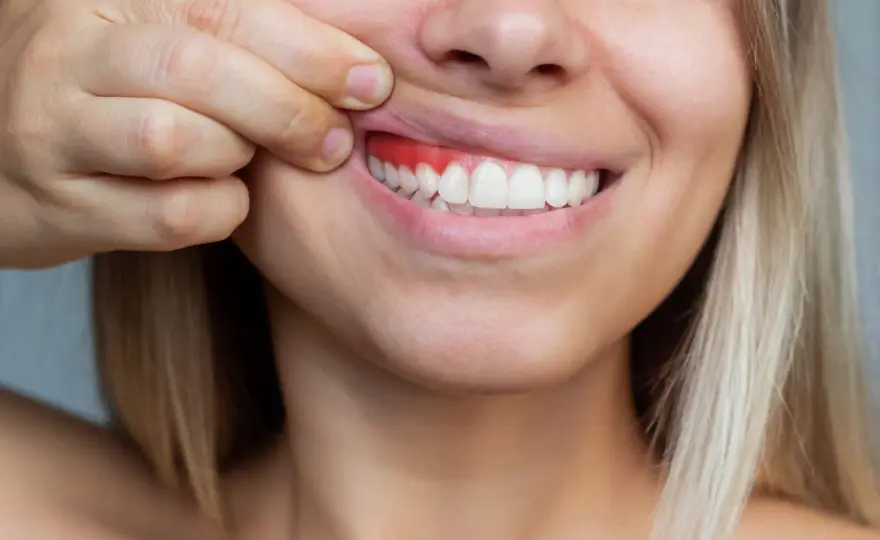 Encías saludables - señales, cuidados y cuándo ir al dentista