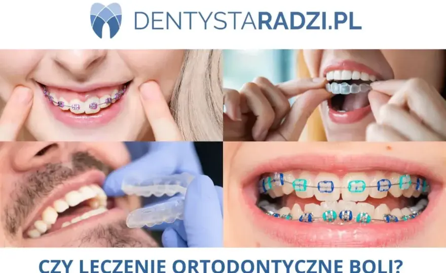 Ból po aparacie ortodontycznym? Szybka ulga i sprawdzone metody