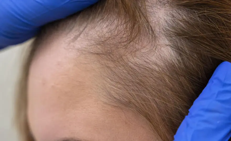 Colágeno para el pelo - ¿Funciona o es un mito?