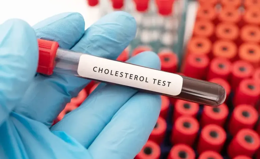 Jakie badanie na cholesterol wybrać, aby zadbać o zdrowie serca?