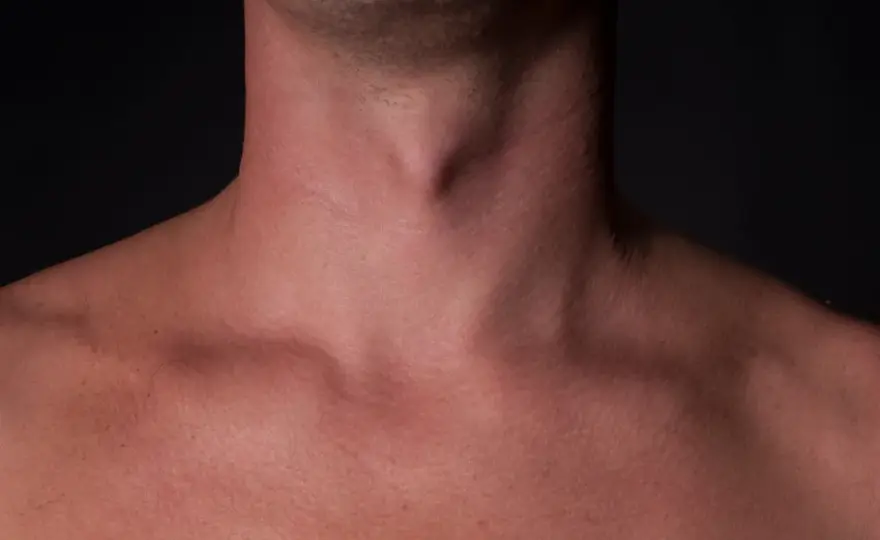Jabłko Adama u mężczyzn - poznaj prawdę o tej męskiej cesze anatomicznej