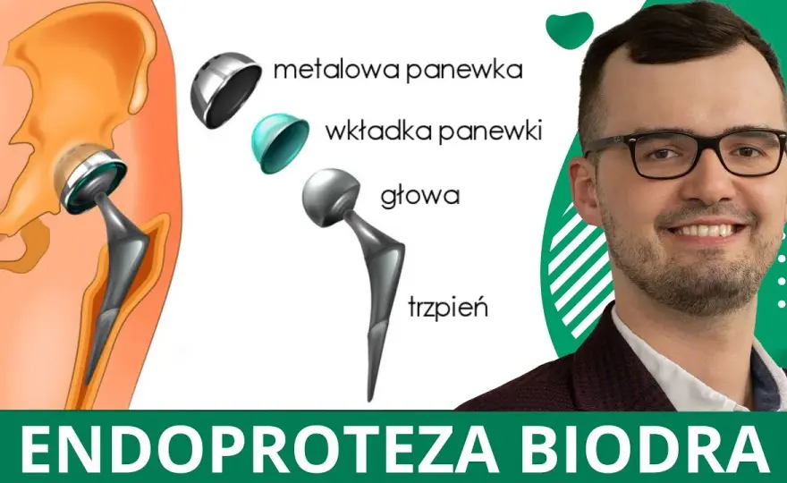 Jakie badania przed operacją endoprotezy: uniknij nieprzyjemnych niespodzianek