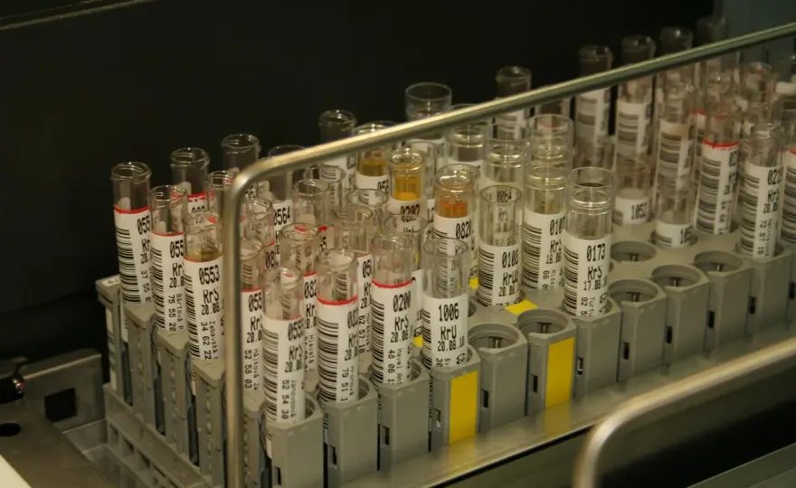 Nie każda probówka jest taka sama. Jak wybrać odpowiednią do profesjonalnego laboratorium?