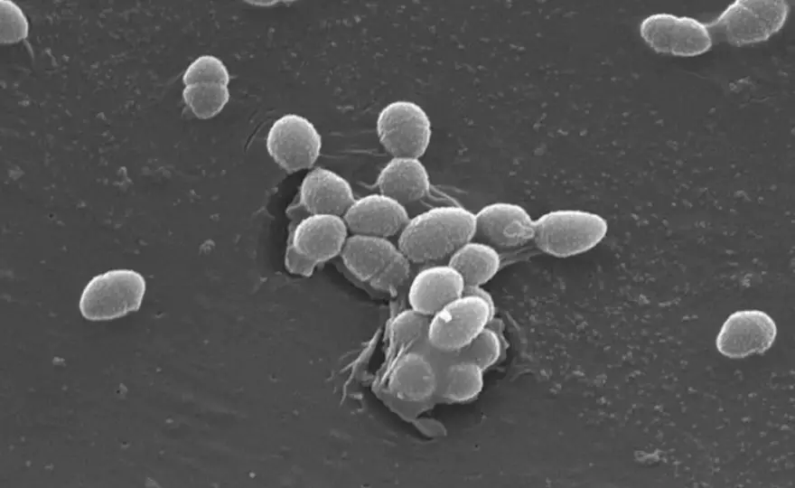 Enterococcus faecalis w moczu: Jak leczyć? Skuteczne metody