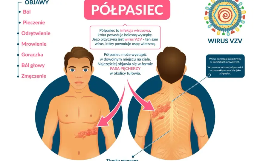 Najczęstsze objawy półpaśca - poznaj pierwsze niepokojące sygnały choroby
