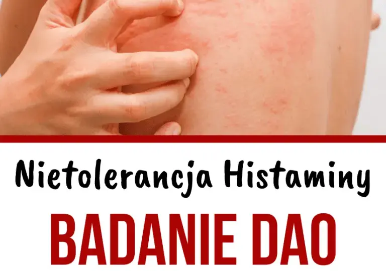 Niedobór DAO: jakie są objawy i jak diagnozować ten stan?