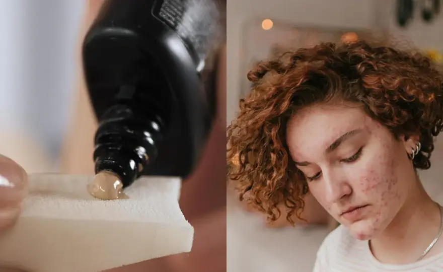 Jaki krem BB do cery trądzikowej, który naprawdę działa na skórę?
