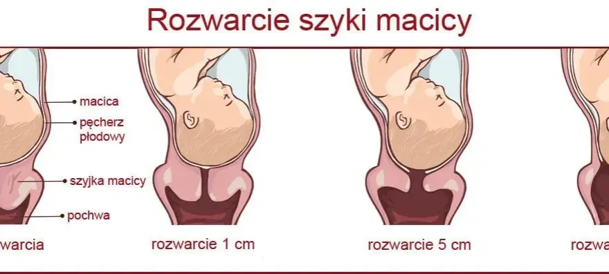 Rozwarcie na 2 palce: ile cm to jest i co oznacza w porodzie?