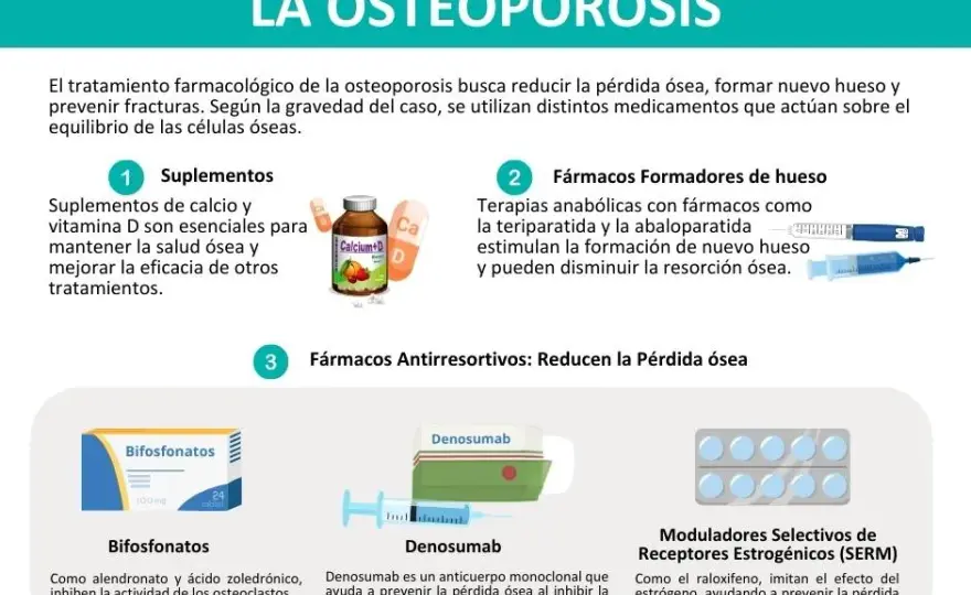 Medicamentos para la osteoporosis: opciones efectivas y riesgos a considerar