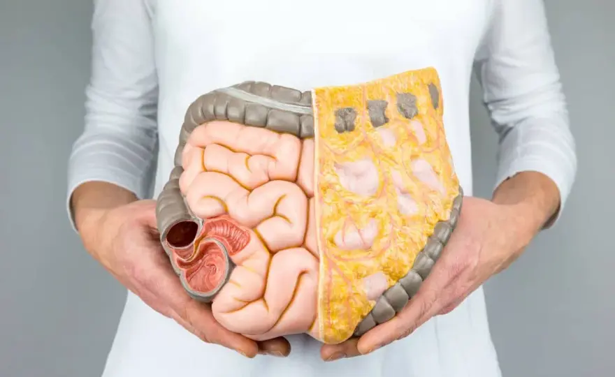 Lactobacillus plantarum 299v w terapii SIBO: Efekty i zastosowanie