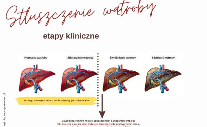 Stłuszczenie wątroby - Jak wyleczyć? Mój plan krok po kroku