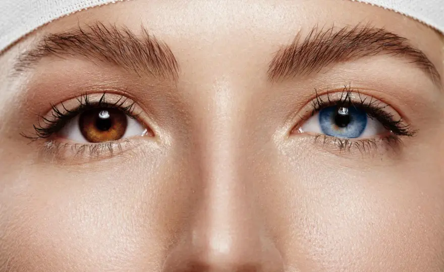 Heterochromia oka - kiedy różne kolory tęczówek są problemem?