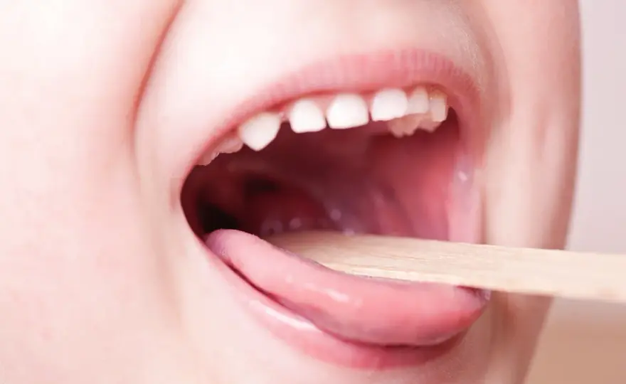 Quanto dura la faringite nei bambini? Tempi e segnali